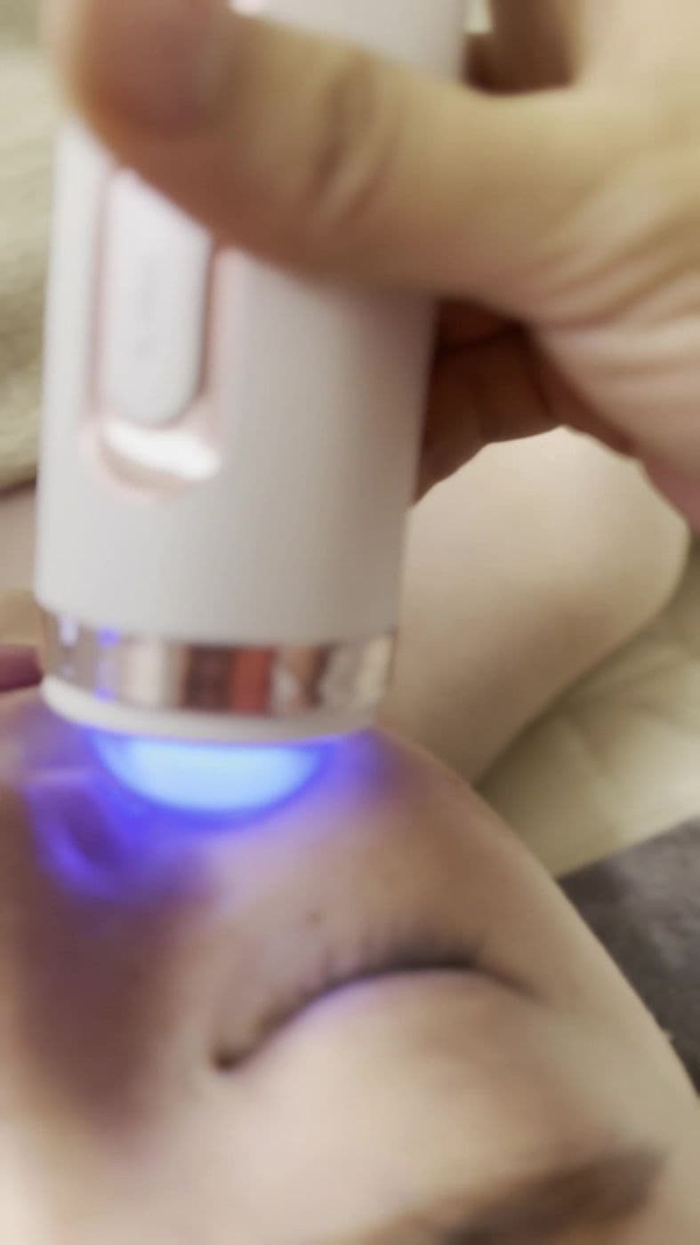 Plasma head close to a client's face during a facial